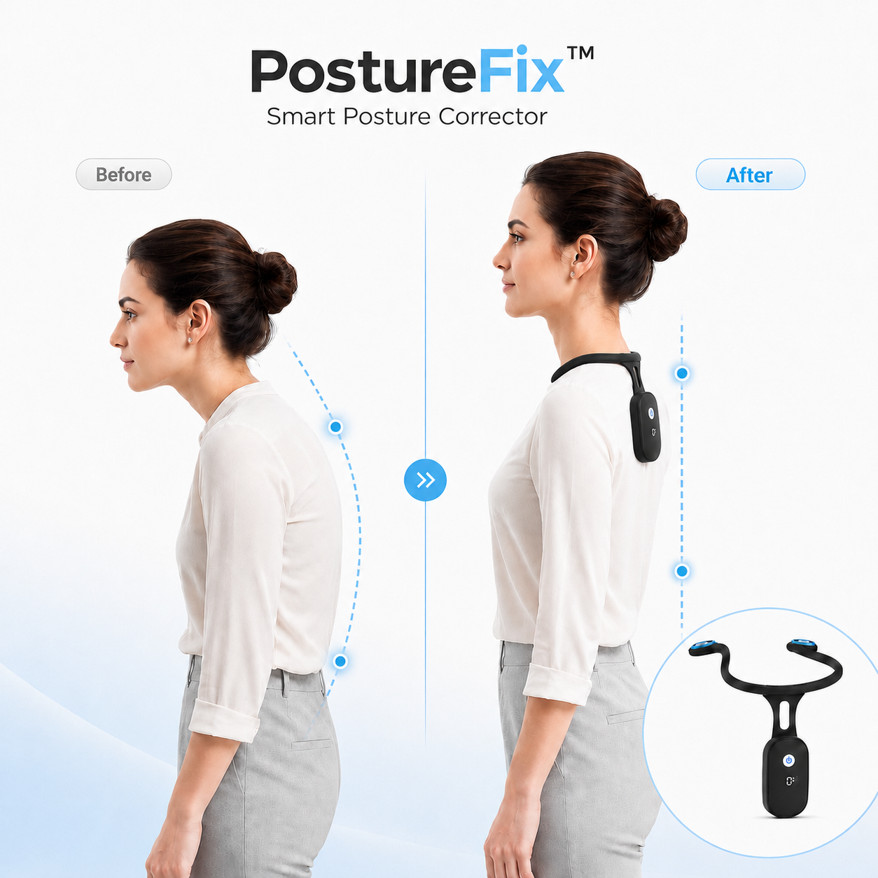 PostureFix before and after posture comparison