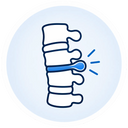 Herniated Discs