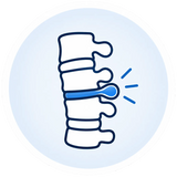 Herniated Discs